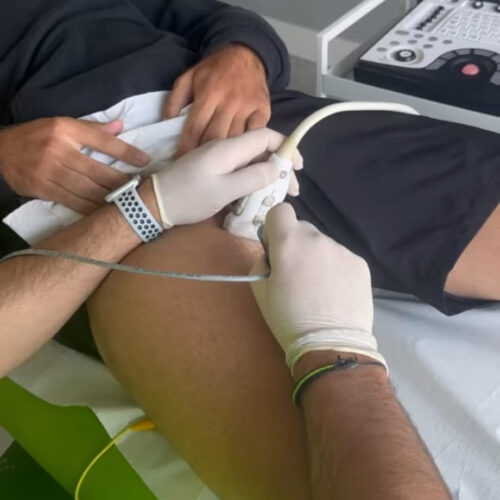 tratamineto imvasivo tratamineto imvasivo